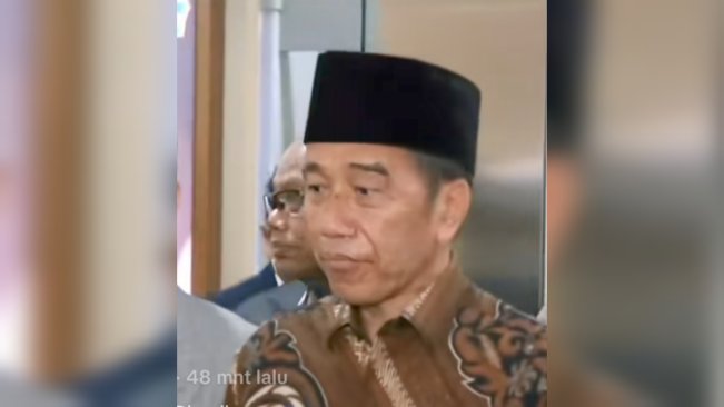 Mengenal Alopecia, Rambut Rontok yang Diduga Dialami Mantan Presiden Jokowi